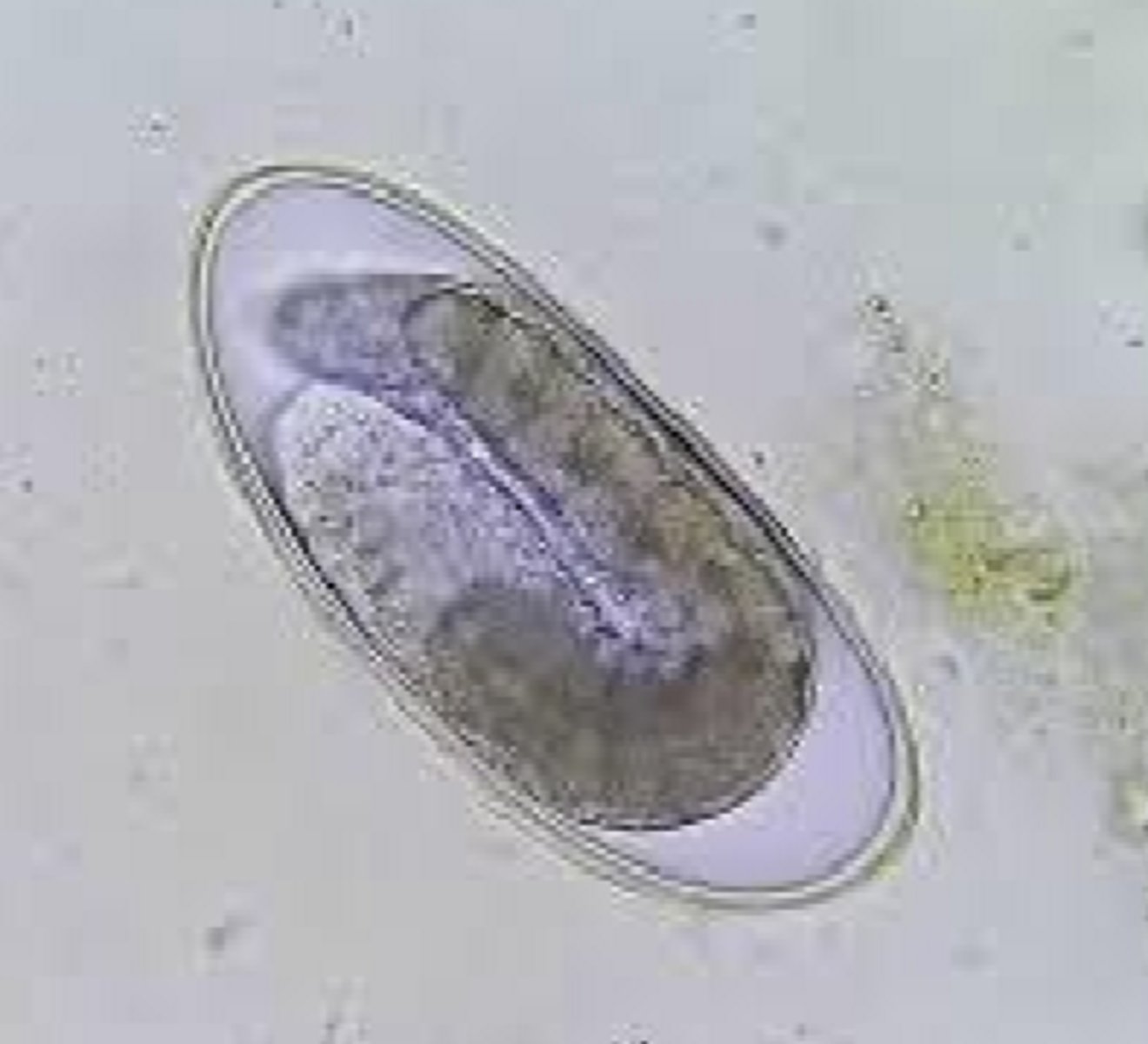 <p>Sheep, Goats, Cattle</p><p>Large Intestine</p>