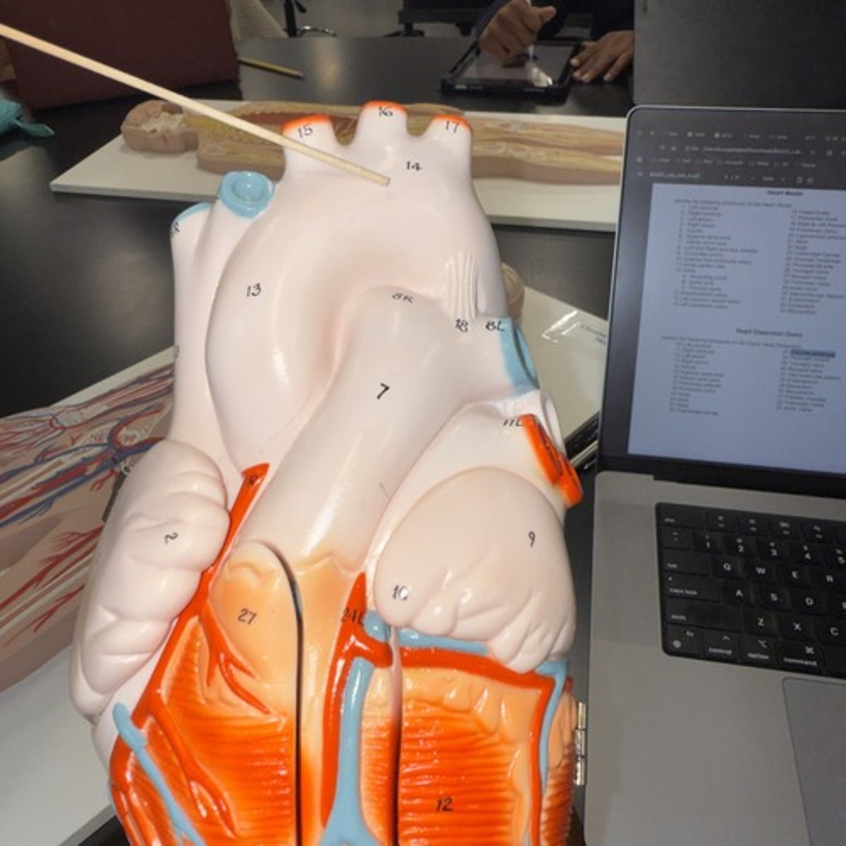 <p>Identify the structure.</p>