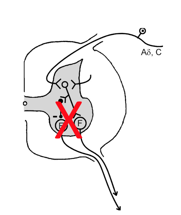 <p>When is co-contraction of antagonists used (in terms of reciprocal inhibition)?</p>