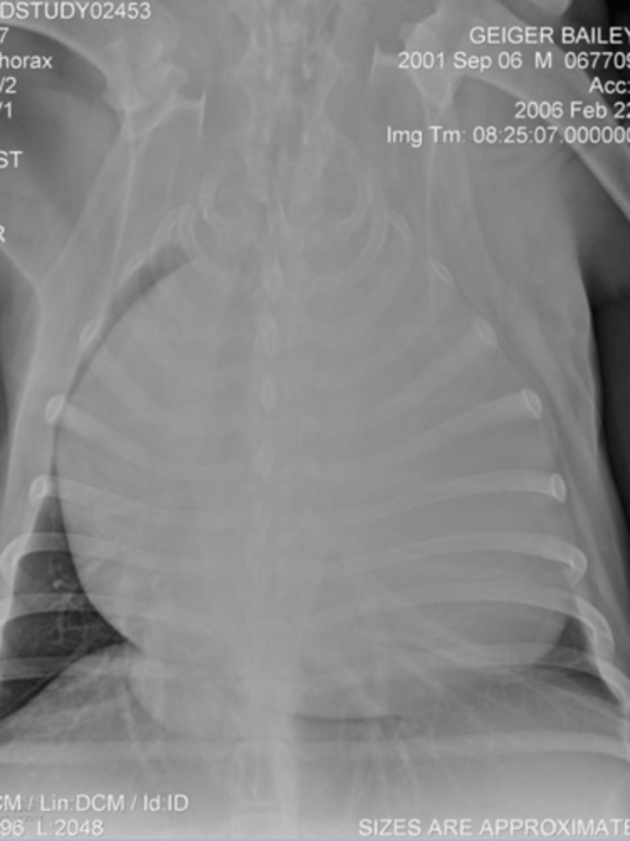 <p>What is the DX?</p>