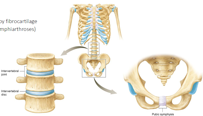 <ul><li><p>Type of cartilaginous joint</p></li><li><p>Bones joined by fibrocartilage</p></li><li><p>Partially moveable joints (amphiarthroses)</p></li><li><p>Ex</p><ul><li><p>Intervertebral joints</p></li><li><p>Pubic symphysis</p></li></ul></li></ul><p></p>