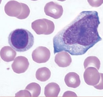<p><span style="font-family: "Times New Roman", serif">Second most common WBC. Includes B and T cells; central to adaptive immunity (antibody production and cytotoxic response).</span></p>