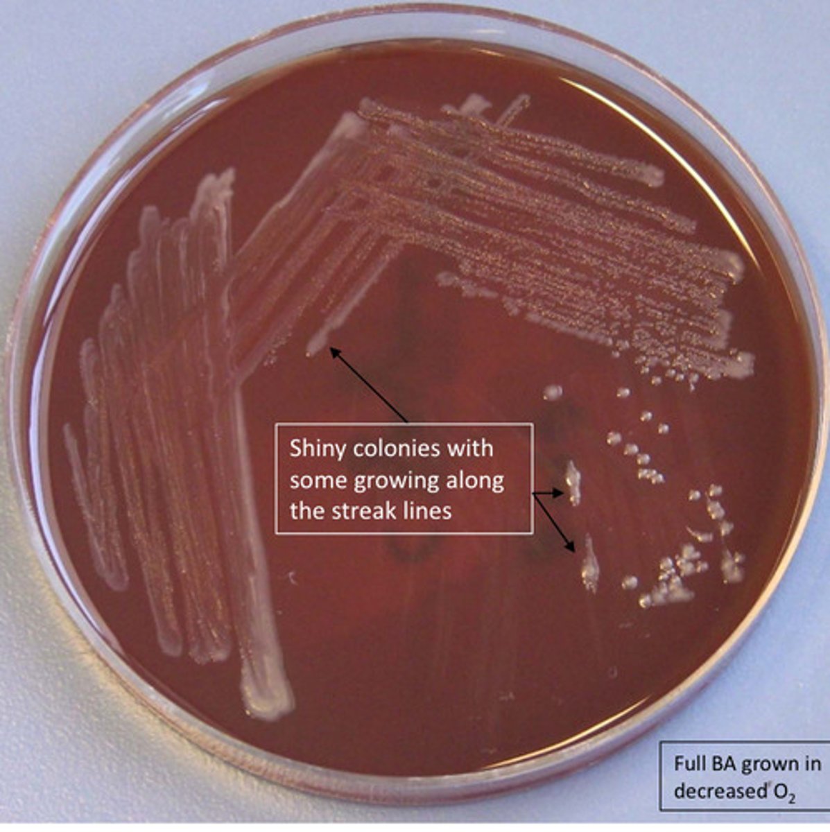 <p>GNB, oxidase pos, watery teardrop growth, helical/curved bacilli, microaerophilic</p>
