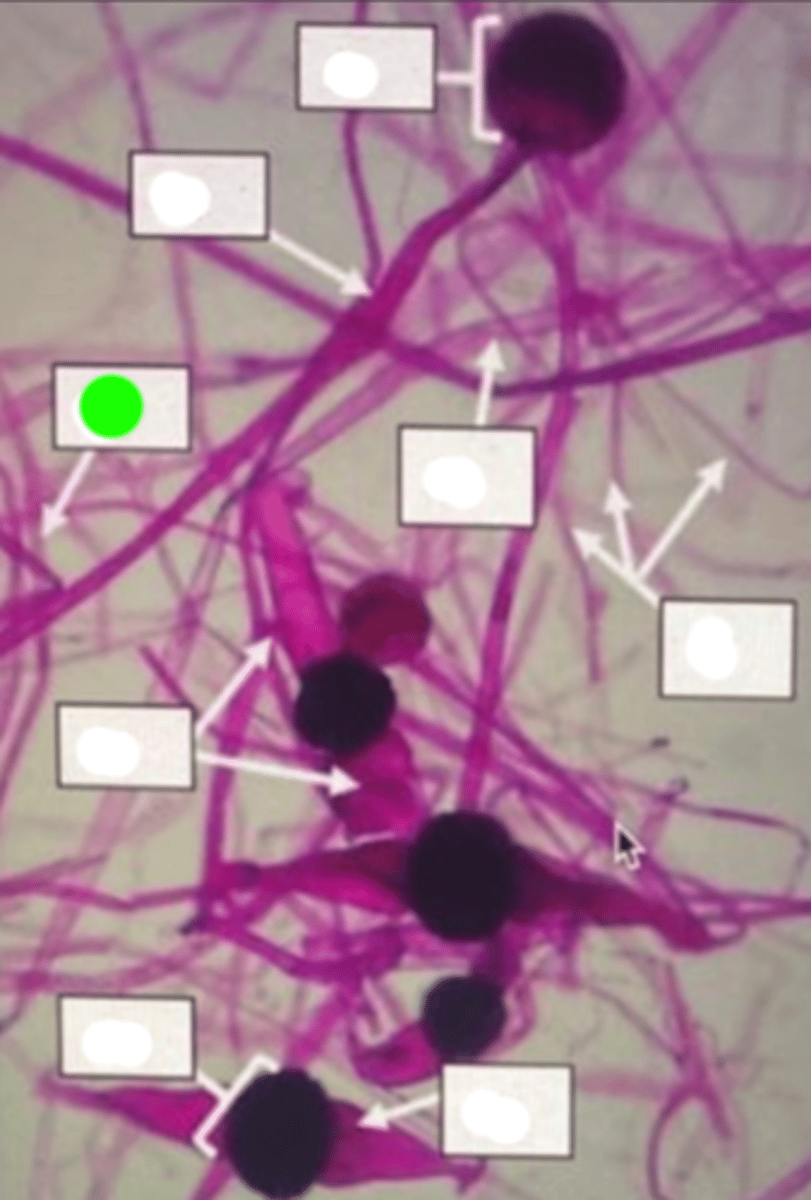 <p>Horizontal hyphal strands connecting different colonies of the fungus, facilitating the spread and colonization of new areas.</p>