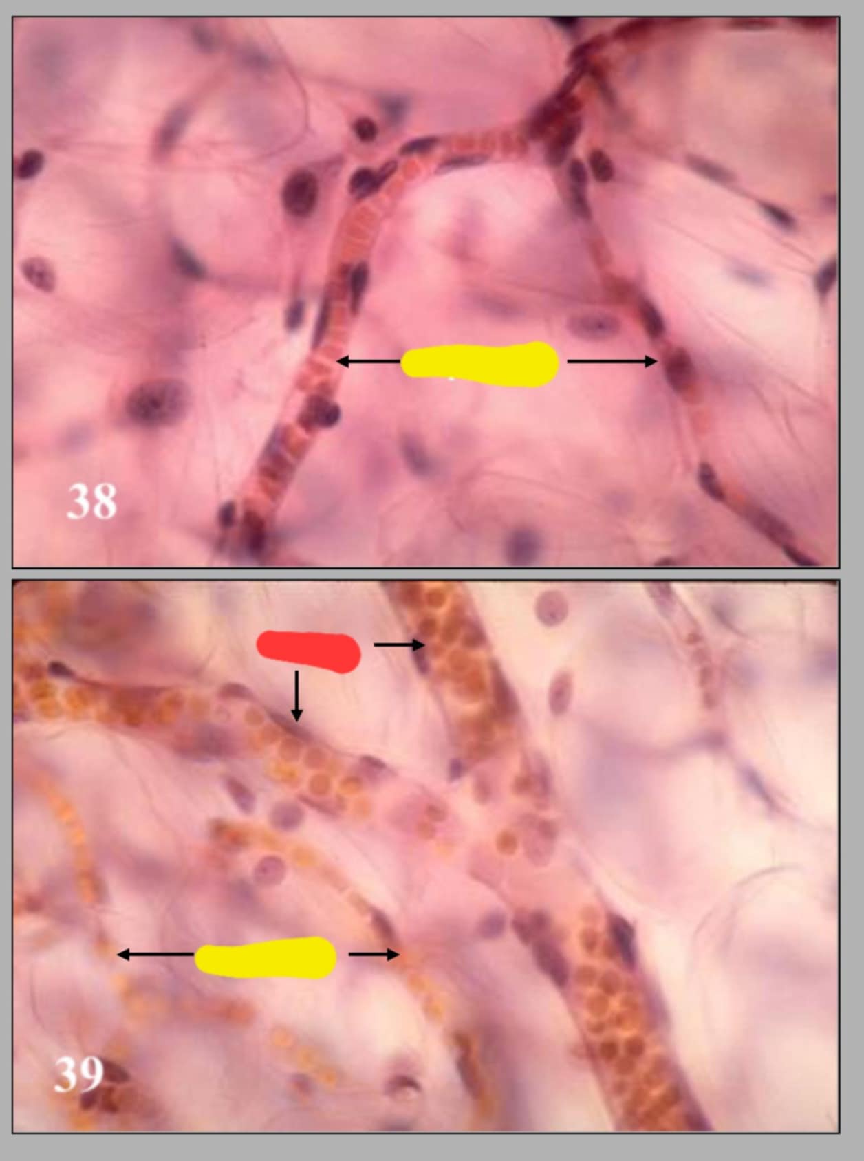 <p>name of the 2 diff slides and their parts</p>