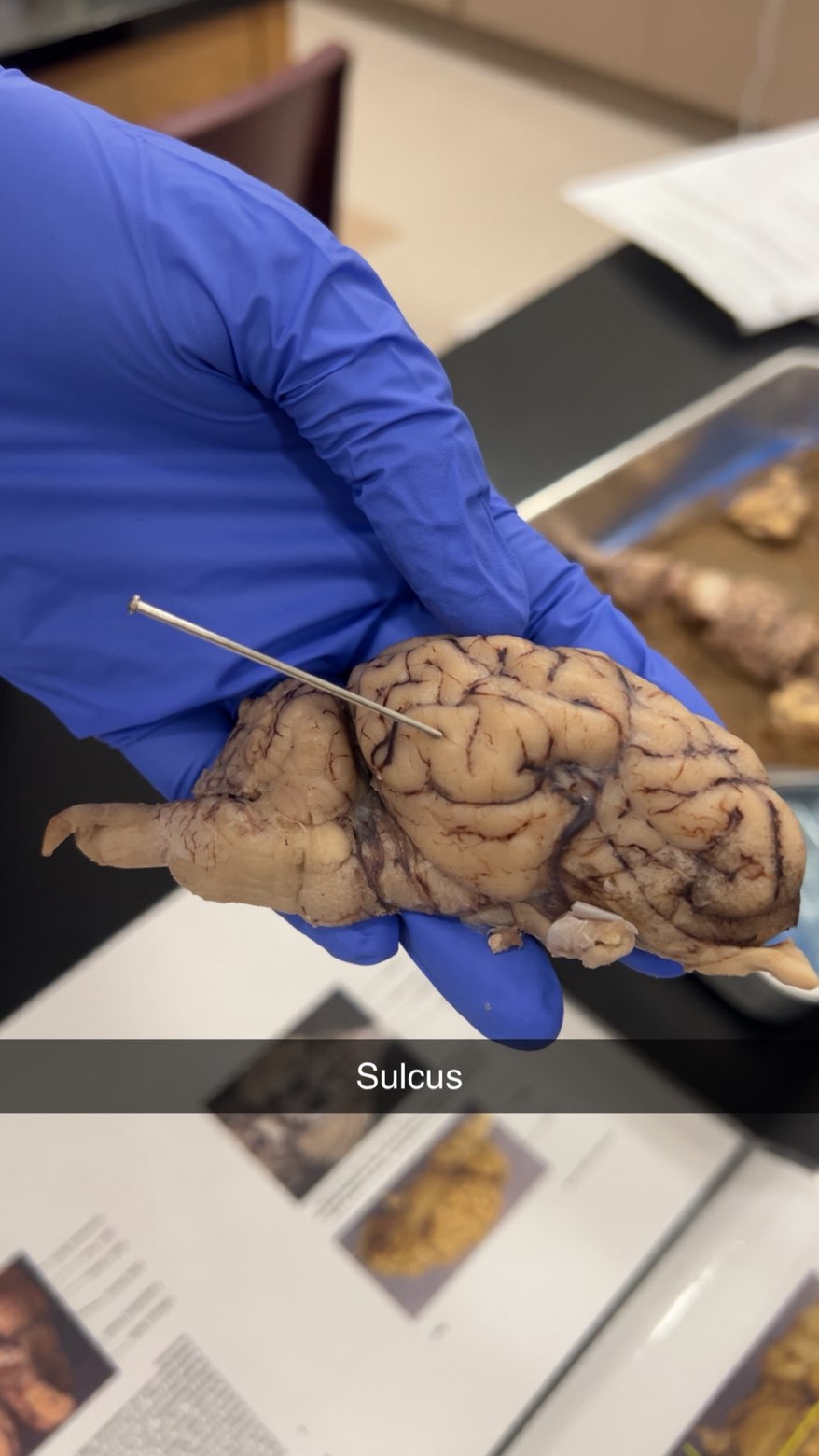 <p>sulcus</p>