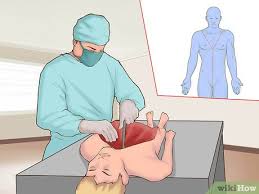 <p>1- External examination (tattoos, scars, birthmarks…)</p><p>2- Internal examination (Y incision is made to expose organs from shoulder-breastbones)</p><p>3- Viewing internal organs (ribs sawn off to expose internal organs)</p><p>4- Removal of organs (Rokitansky method (removing all organs at once))</p><p>5- Removal of brains (Incision made in the back of scalp from ear-ear) </p><p>6- Examining organs (All organs except stomach and intestines are weighed)</p><p>7- Returning organs to body (organs returned to body except for small tissue frags. for microscope examination) </p><p>8- Sewing up the body  (Incisions stitched up like a baseball) </p>