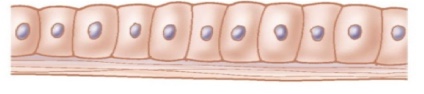 <p>What cellular adaptation is this?</p>