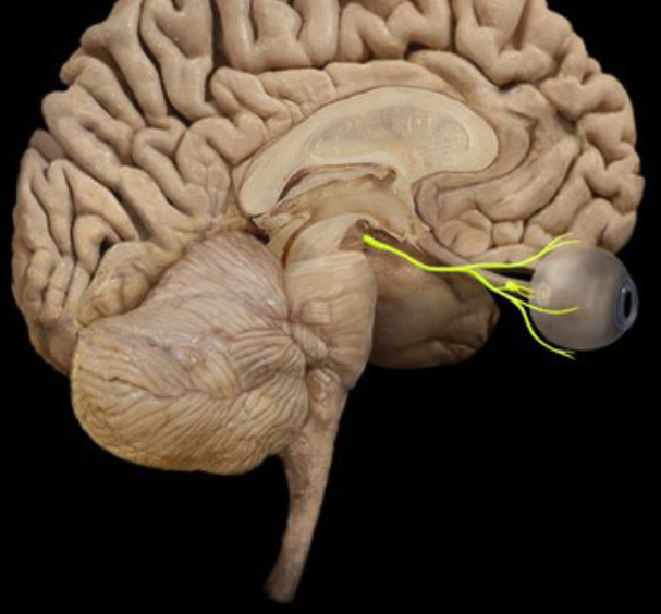 term image