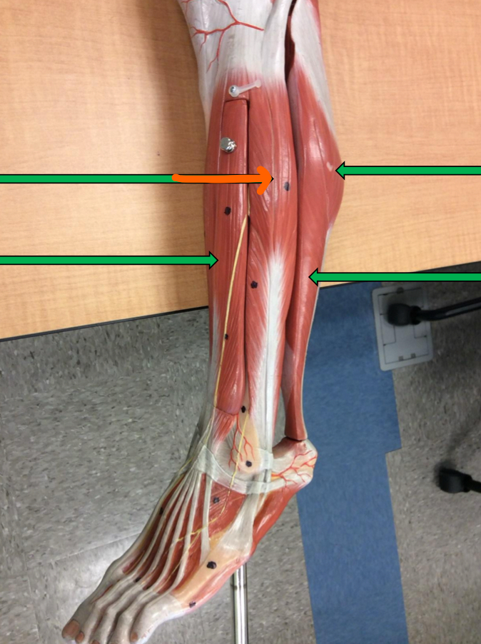 <p>Identify this muscle?</p>