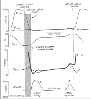 <ul><li><p class="">La&nbsp;<strong>pression ventriculaire (PLV)</strong></p></li><li><p class="">La&nbsp;<strong>pression auriculaire (PLA)</strong></p></li></ul><p></p>