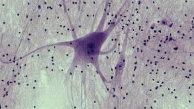 <p>Nerve Tissue</p>