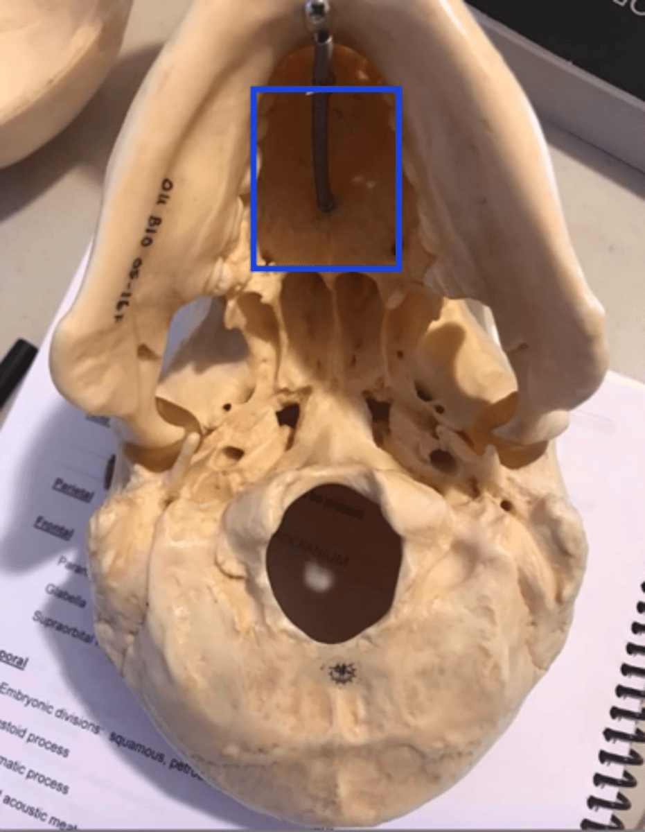 <p>What structures/features make up the palate?</p>