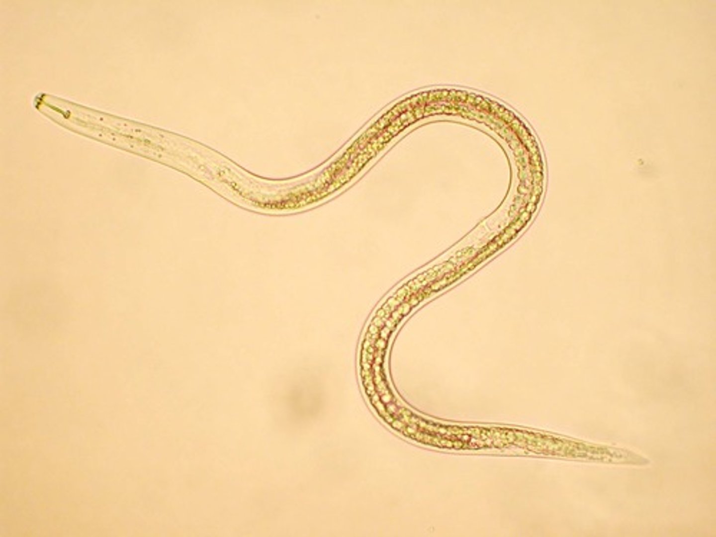 <p>- Ubiquitous, abundant, and habitat/host specific group of ecdysozoans</p><p>- Worm-like body</p><p>- Tube within a tube body plan</p><p>- Mostly acoelomates but larger kinds are pseudocoelomates</p><p>- Look similar on the surface, but molecularly they are differnt</p><p>- Most are small and transparent</p><p>- Tapered at both ends</p><p>- Homogeneus</p><p>- Most abundant organisms on Earth</p><p>- Most are parasites</p><p>- Feed on bacteria and fungi (control decomposers)</p><p>- Fluid in pseudocoelom maintained by high pressure</p><p>- Can grow in between molts</p><p>- Have eutely of 959</p><p>- Most body cells lose genetic material as they age</p><p>- Only possess longitudinal muscles</p><p>- Thrashing, whip-like movement</p><p>- Possess spicules</p><p>- Females larger than males because of reproductive output</p><p>- Ex: Caenorhabditis elegans, roundworms, and hookworms</p>