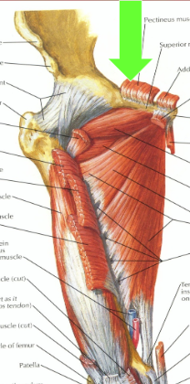 O - Pubic Bone

I - Distal lesser Trochanter

A - Hip Flexion ADDuctor, Ext. Rotation

N - Femoral n.