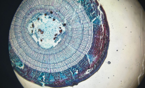 dicot stem