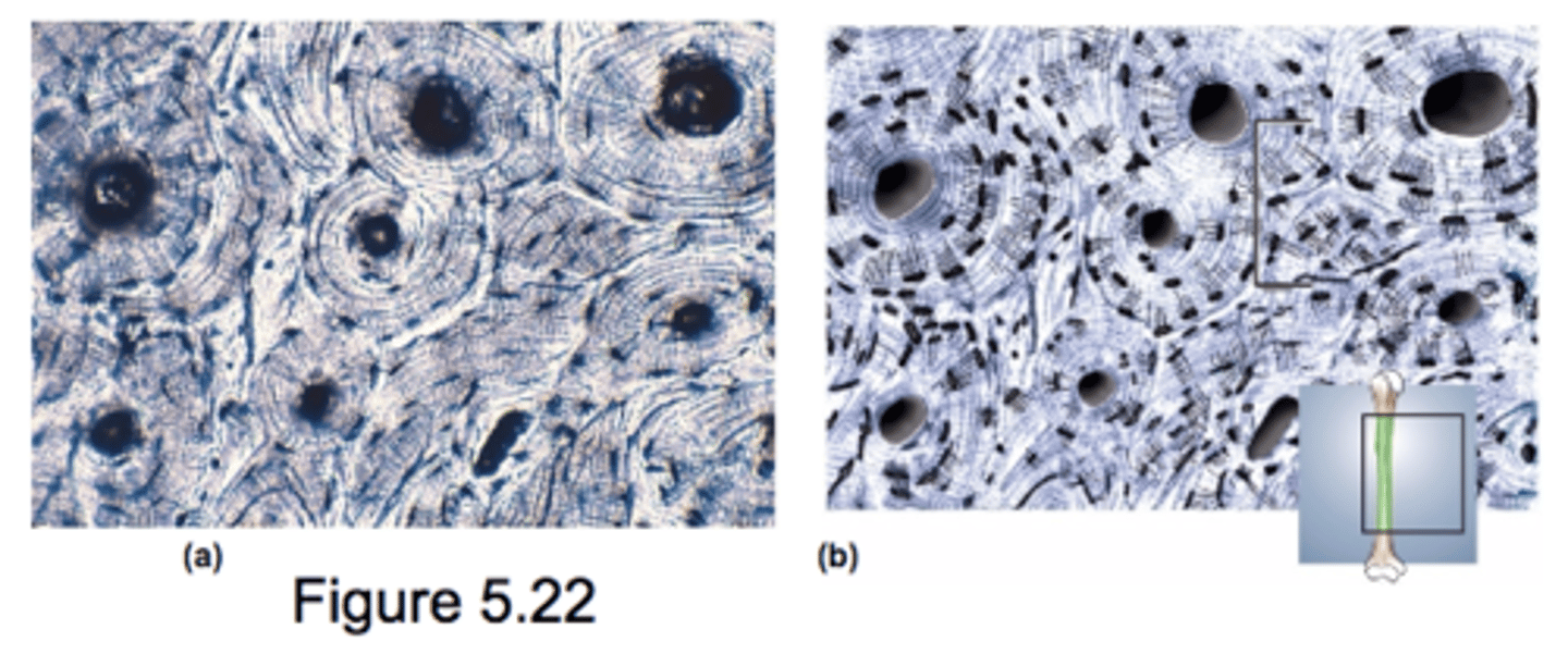 <p>low cellular proportion: primarily solid extracellular matrix</p><p>osteocytes are defining cell type</p>