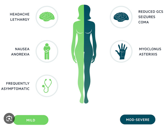 <ul><li><p>Characterized by too much ADH in the body.</p></li><li><p>Patient retains too much fluid, does not urinate frequently.</p></li><li><p>Retention can cause headaches, diuresis, and edema.</p></li><li><p>Must monitor sodium levels, additional sodium may worsen symptoms.</p></li></ul><p></p>