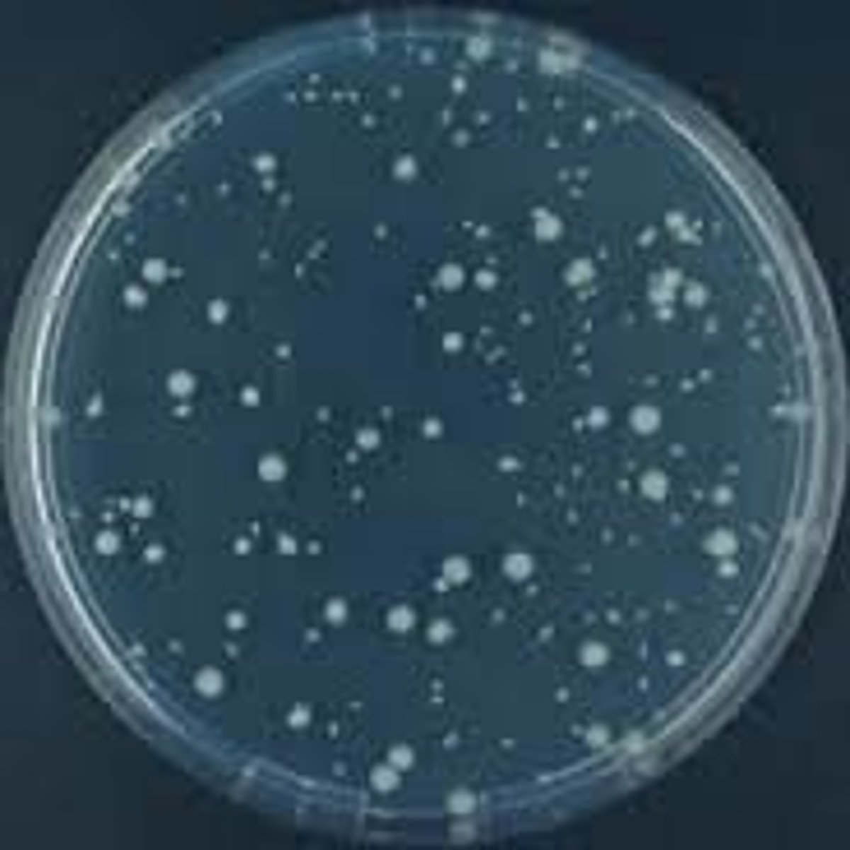 <p>Small smooth round colonies with many possible colors</p>