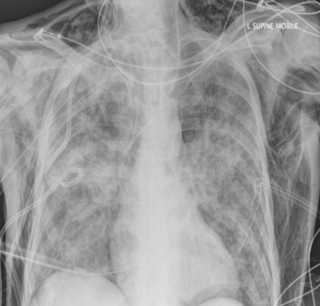 <p>what is happening in this patient?</p>