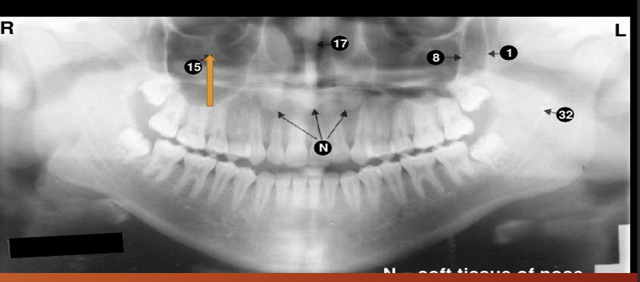 <p><strong>15?</strong></p>