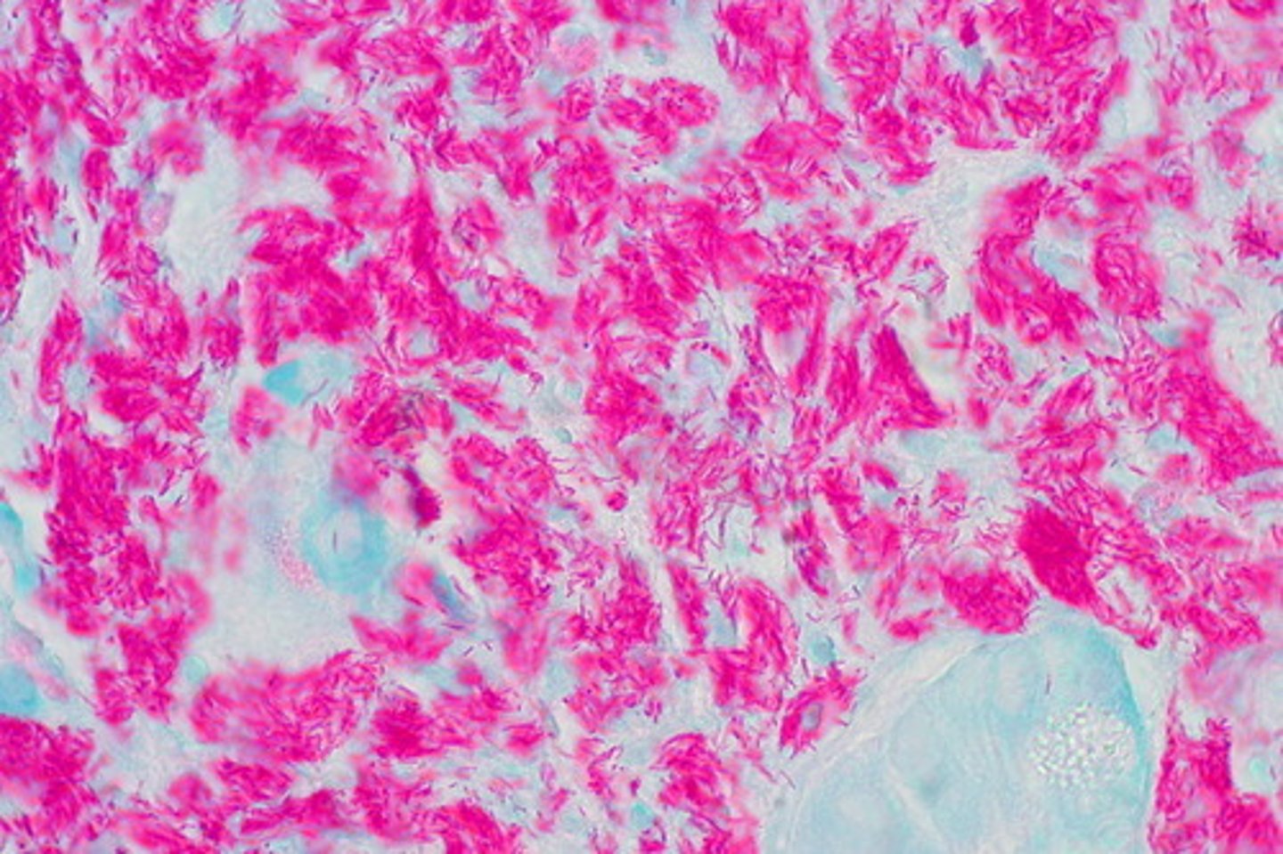 <p>Stains Fuchsia (pink)</p><p>NON ACID FAST STAIN is BLUE/GREEN</p>