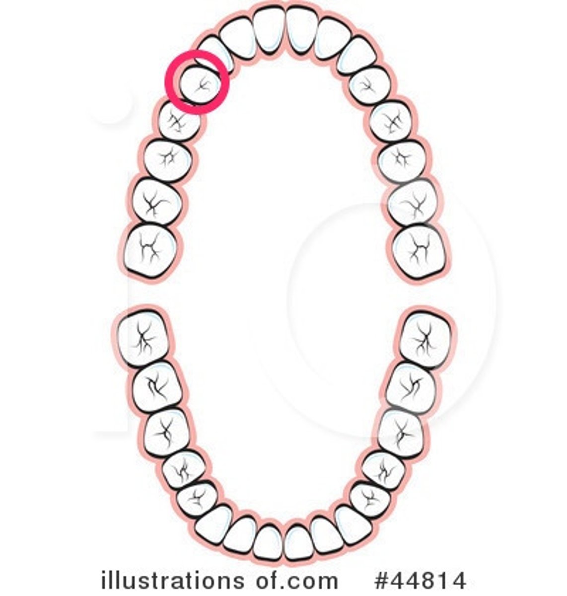 <p>UR 1st premolar</p>