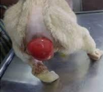 <p><span>Rectal Prolapse</span></p>