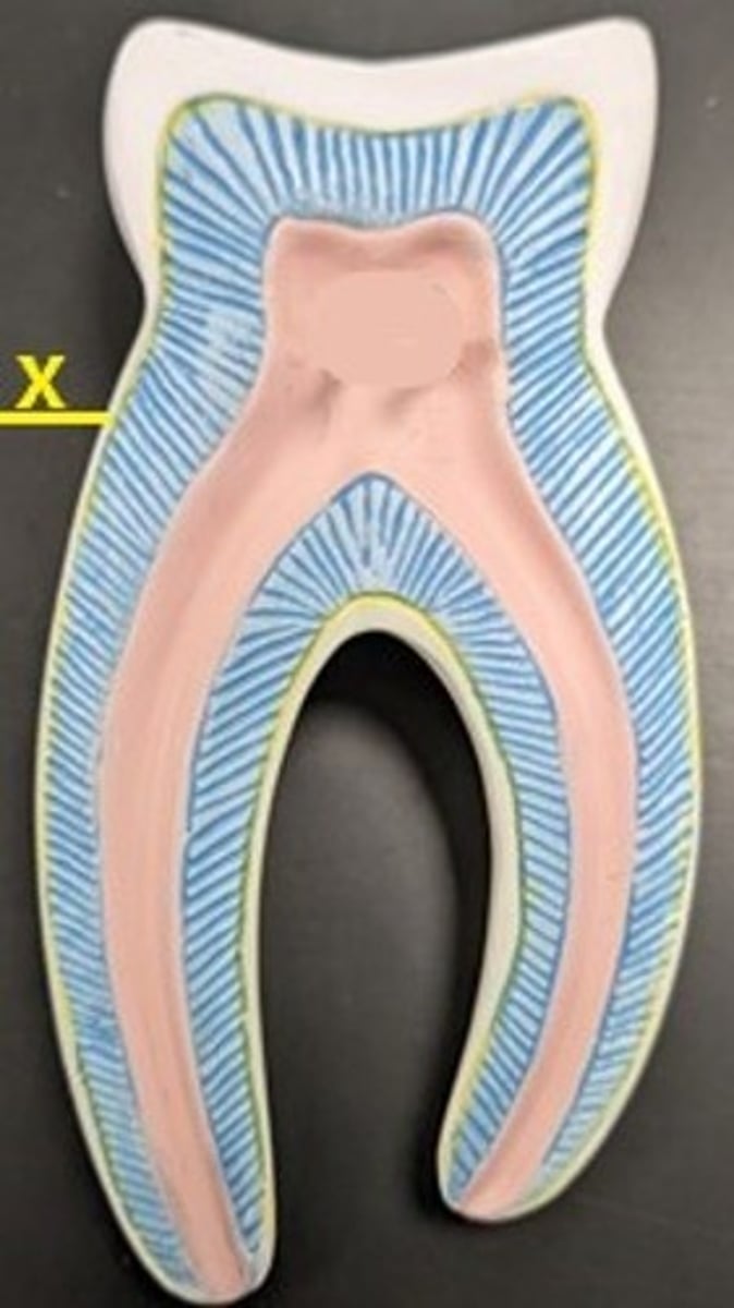 <p>ID the Tooth Structure in Yellow</p>