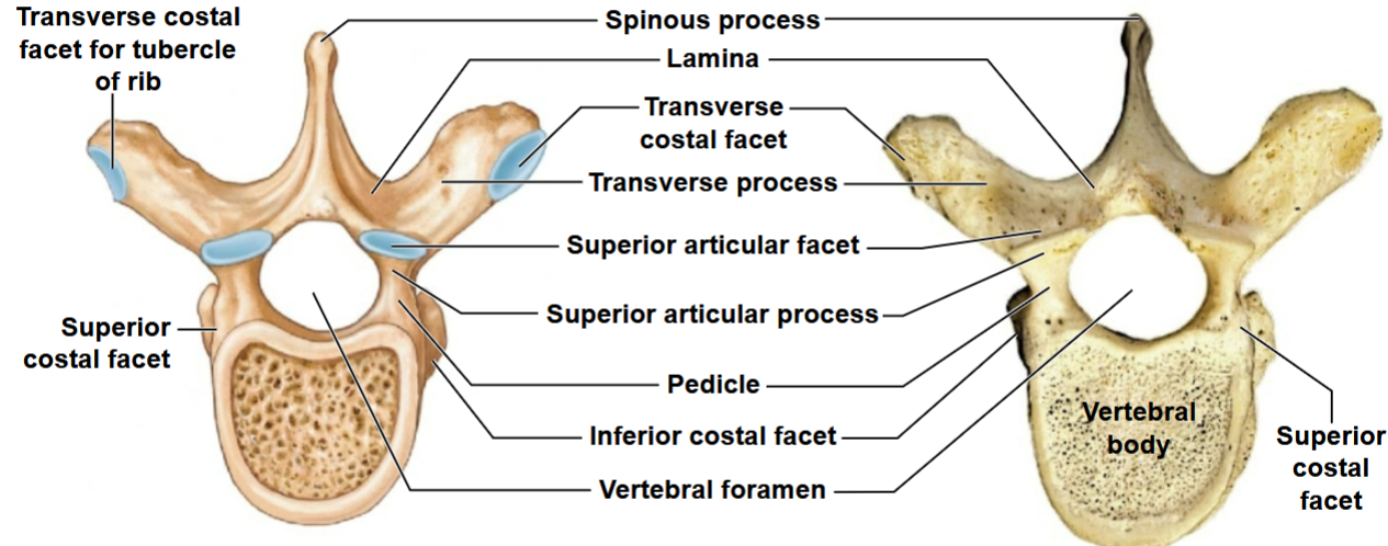 <p>What view of the thoracic vertebrae is this?</p>