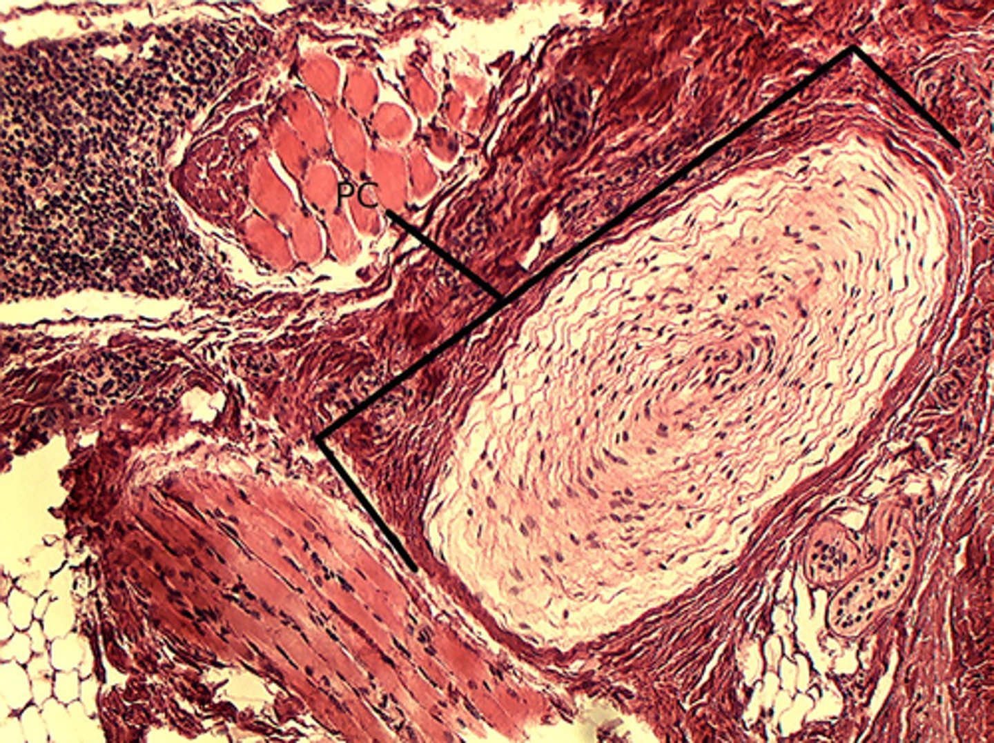 <p>what is the structure in the bracket called?</p>
