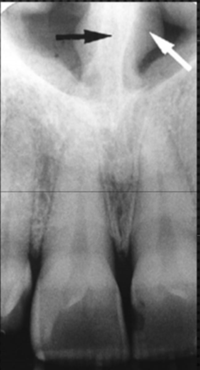 <p>Identify both structures</p>