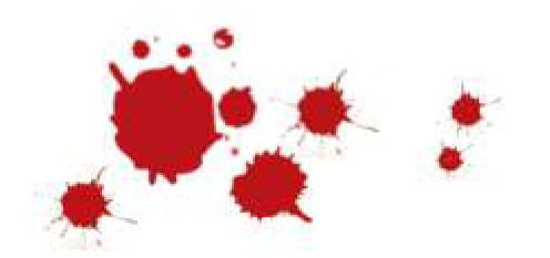 <p>What bloodstain patterns are shown here?</p>
