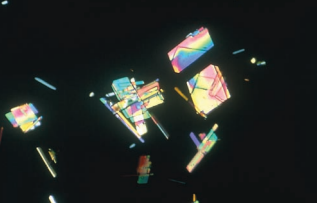 Cholesterol crystals under polarized light