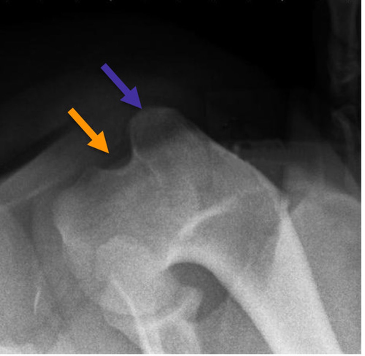 <p>What is the orange arrow pointing to?</p>
