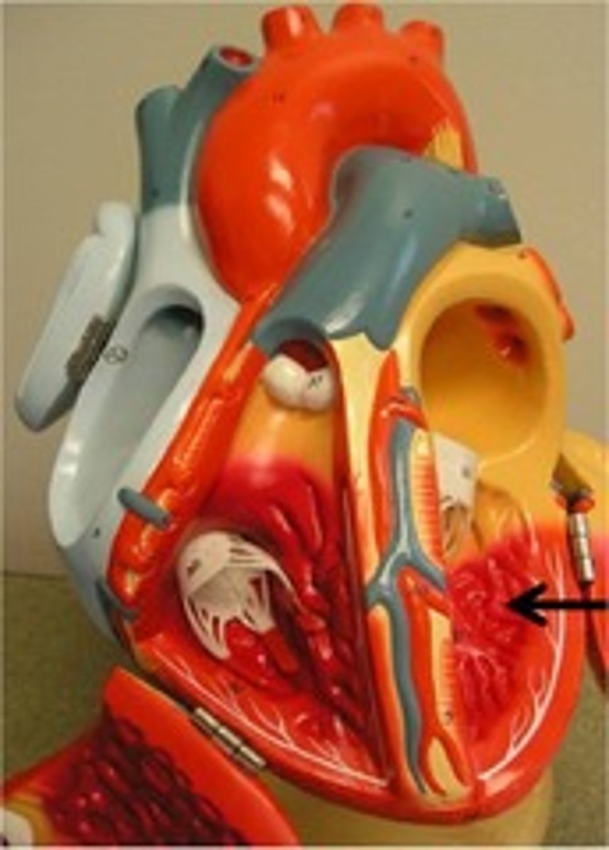 <p>the irregular ridges within the myocardium of the ventricles</p>