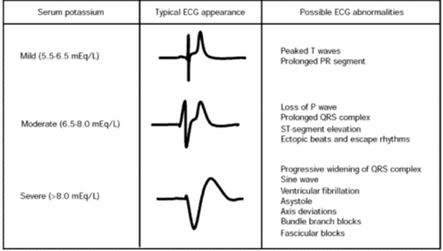 <p>tall T wide QRS</p>