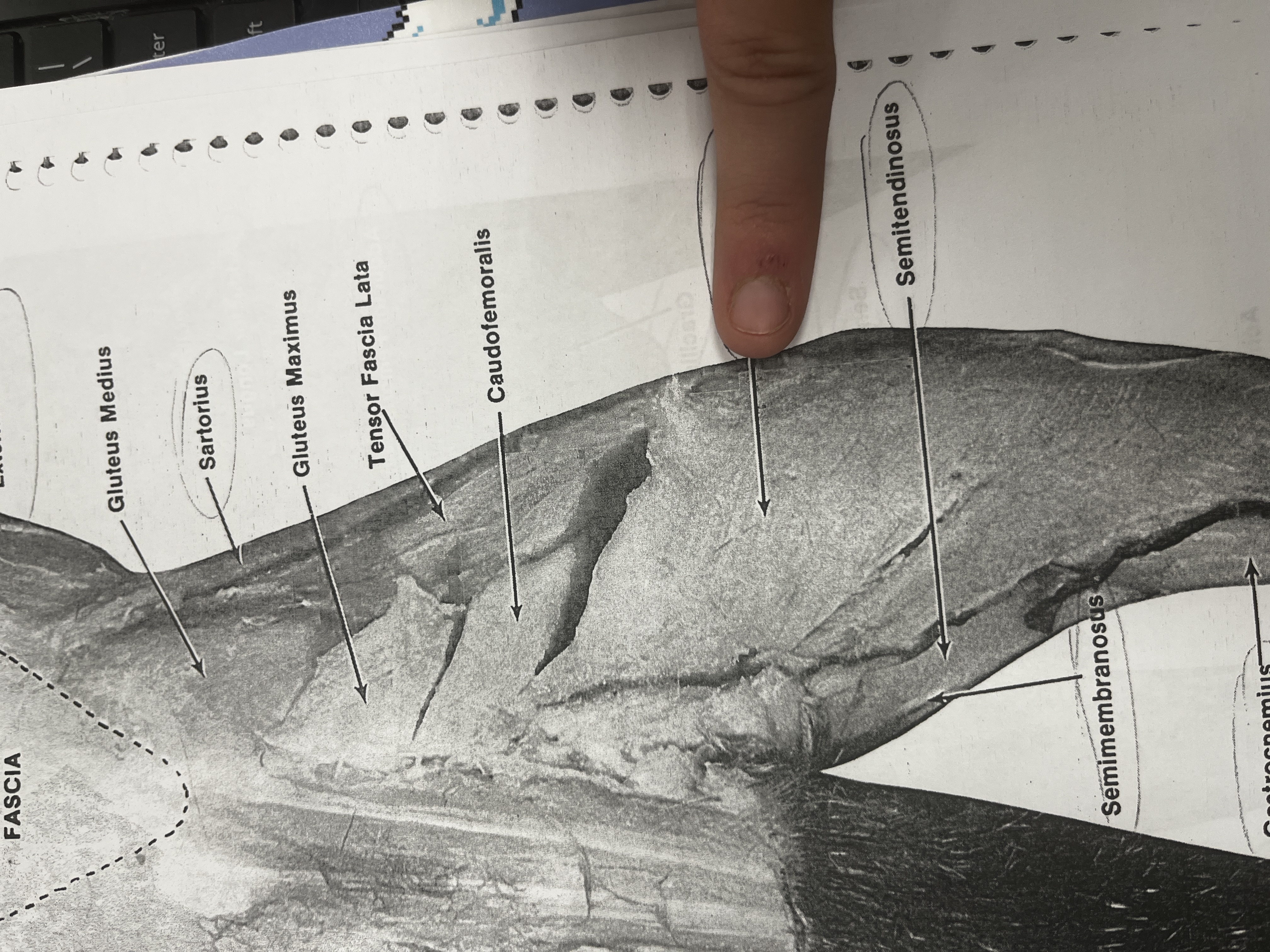 <p>One of the hamstring muscles that flexes the knee and extends the hip.</p>