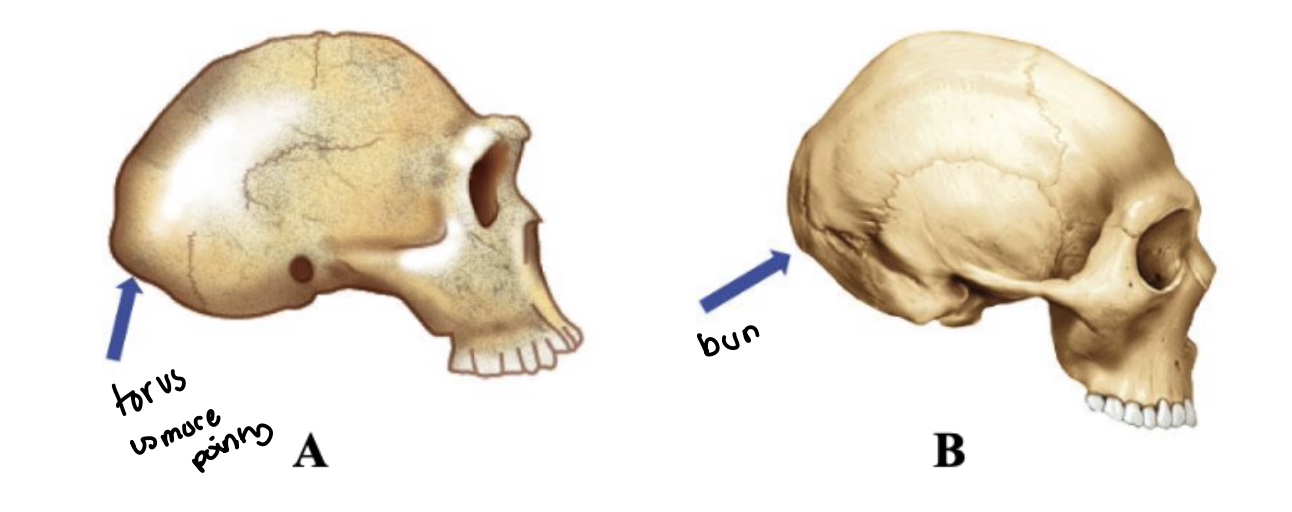 <p>Occipital bun</p>