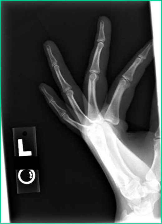 <p><span><span>parts of the anatomy being cut off </span></span></p>