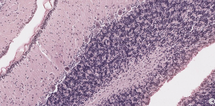 <p>what type of neural tissue is this</p>
