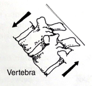 <p>What force is acting on the bone?</p>