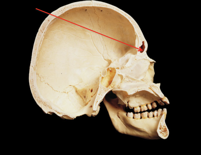 term image