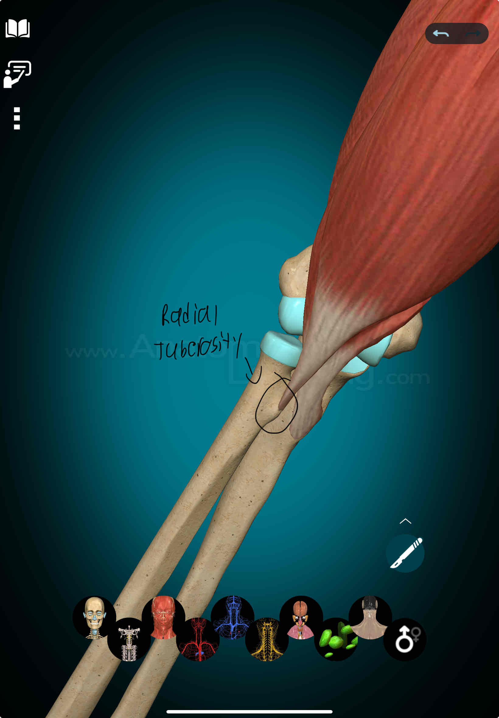 <p>Biceps Brachii Insertion</p>