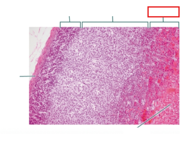 <p>What structure is highlighted?</p>