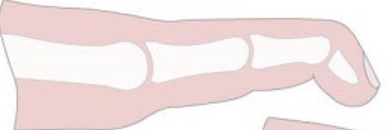 <p>DIP flexion</p>