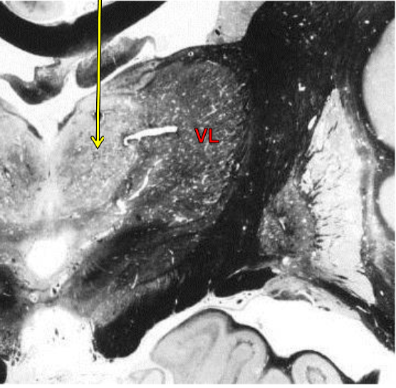 term image