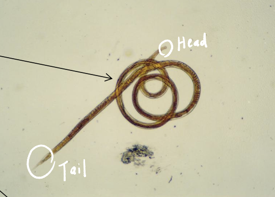 <p><span><span>Which parasites are shown in this picture, and which morphological feature supports this conclusion?</span></span></p>