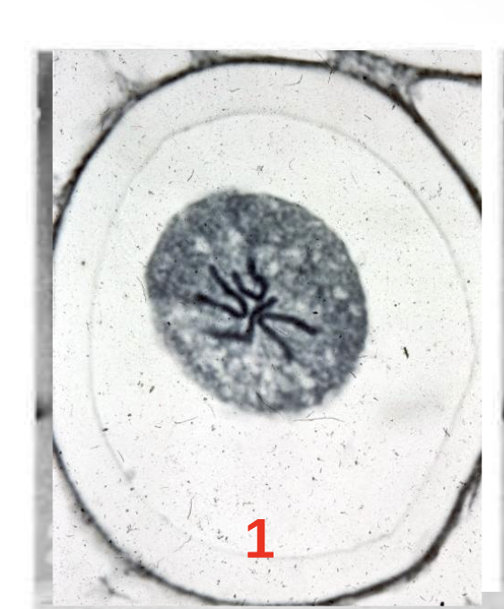 <p>Step 1.) Prophase </p>