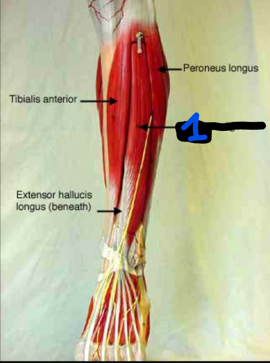 <p><span style="font-family: Arial, sans-serif">Name that muscle</span></p>